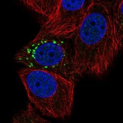 Invitrogen PPM1J Polyclonal Antibody 100 &mu;L | Buy Online | Invitrogen&trade; | Fisher Scientific
