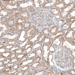 Invitrogen PPM1J Polyclonal Antibody 100 &mu;L | Buy Online | Invitrogen&trade; | Fisher Scientific