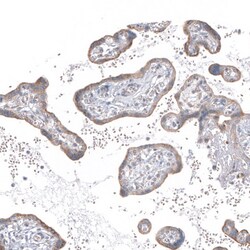 Invitrogen PPM1J Polyclonal Antibody 100 &mu;L | Buy Online | Invitrogen&trade; | Fisher Scientific