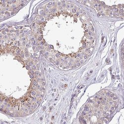 Invitrogen PPM1J Polyclonal Antibody 100 &mu;L | Buy Online | Invitrogen&trade; | Fisher Scientific