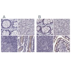 Invitrogen SLC28A2 Polyclonal Antibody 100 &mu;L; Unconjugated:Antibodies,