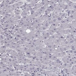 Invitrogen SLC28A2 Polyclonal Antibody 100 &mu;L; Unconjugated:Antibodies,