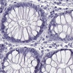Invitrogen SLC28A2 Polyclonal Antibody 100 &mu;L; Unconjugated:Antibodies,