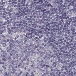 Invitrogen SLC28A2 Polyclonal Antibody 100 &mu;L; Unconjugated:Antibodies,