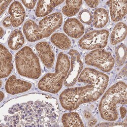Invitrogen NPHP1 Polyclonal Antibody 100 &mu;L; Unconjugated:Antibodies,