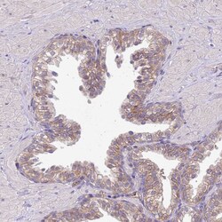 Invitrogen NPHP1 Polyclonal Antibody 100 &mu;L; Unconjugated:Antibodies,