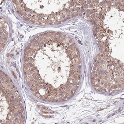 Invitrogen NPHP1 Polyclonal Antibody 100 &mu;L; Unconjugated:Antibodies,