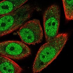 Invitrogen RNF181 Polyclonal Antibody 100 &mu;L; Unconjugated:Antibodies,