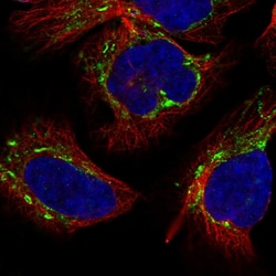 Invitrogen APC13 Polyclonal Antibody 100 &mu;L; Unconjugated:Antibodies,