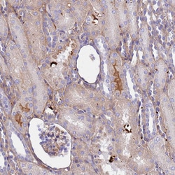 Invitrogen CRHBP Polyclonal Antibody 100 &mu;L; Unconjugated:Antibodies,