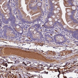 Invitrogen CRHBP Polyclonal Antibody 100 &mu;L; Unconjugated:Antibodies,