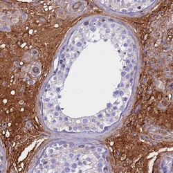 Invitrogen CRHBP Polyclonal Antibody 100 &mu;L; Unconjugated:Antibodies,