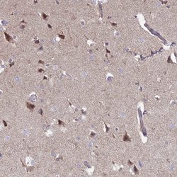 Invitrogen DIP2B Polyclonal Antibody 100 &mu;L; Unconjugated:Antibodies,