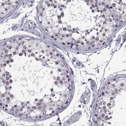 Invitrogen MAGEB18 Polyclonal Antibody 100 &mu;L; Unconjugated:Antibodies,