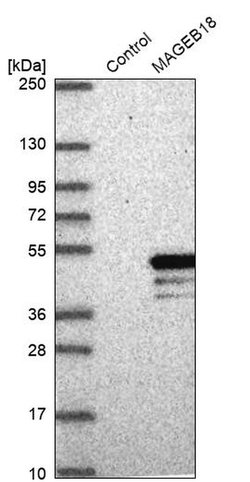 Invitrogen MAGEB18 Polyclonal Antibody 100 &mu;L; Unconjugated:Antibodies,