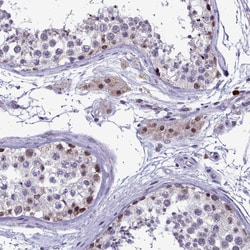 Invitrogen POM121L2 Polyclonal Antibody 100 &mu;L; Unconjugated:Antibodies,