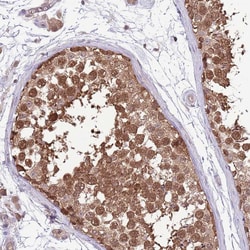Invitrogen AMIGO1 Polyclonal Antibody 100 &mu;L; Unconjugated:Antibodies,