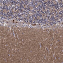 Invitrogen AMN1 Polyclonal Antibody 100 &mu;L; Unconjugated:Antibodies,
