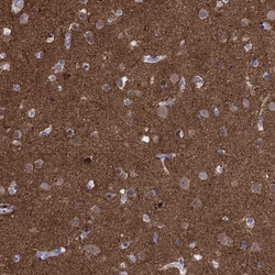 Invitrogen AMN1 Polyclonal Antibody 100 &mu;L; Unconjugated:Antibodies,