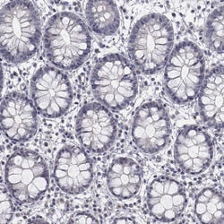Invitrogen AMN1 Polyclonal Antibody 100 &mu;L; Unconjugated:Antibodies,