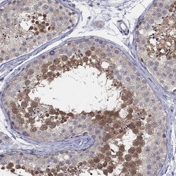 Invitrogen AMN1 Polyclonal Antibody 100 &mu;L; Unconjugated:Antibodies,