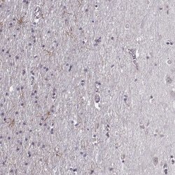 Invitrogen LUZP2 Polyclonal Antibody 100 &mu;L; Unconjugated:Antibodies,
