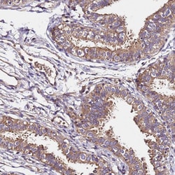Invitrogen LRRIQ1 Polyclonal Antibody 100 &mu;L; Unconjugated:Antibodies,
