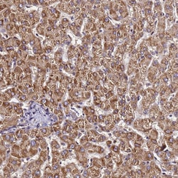 Invitrogen LRRIQ1 Polyclonal Antibody 100 &mu;L; Unconjugated:Antibodies,