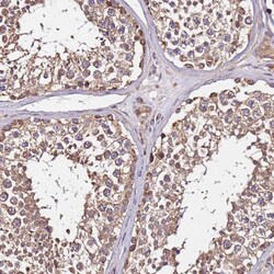 Invitrogen LRRIQ1 Polyclonal Antibody 100 &mu;L; Unconjugated:Antibodies,