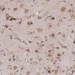 Invitrogen GDAP2 Polyclonal Antibody 100 &mu;L; Unconjugated:Antibodies,