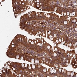 Invitrogen GRTP1 Polyclonal Antibody 100 &mu;L | Buy Online | Invitrogen&trade; | Fisher Scientific