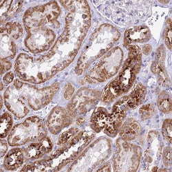 Invitrogen PNLIPRP3 Polyclonal Antibody 100 &mu;L; Unconjugated:Antibodies,