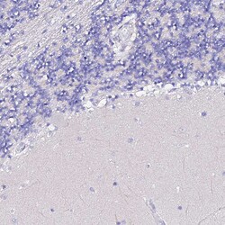 Invitrogen TMEM117 Polyclonal Antibody 100 &mu;L | Buy Online | Invitrogen&trade; | Fisher Scientific