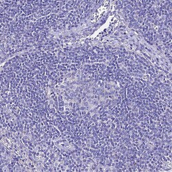 Invitrogen TMEM117 Polyclonal Antibody 100 &mu;L | Buy Online | Invitrogen&trade; | Fisher Scientific