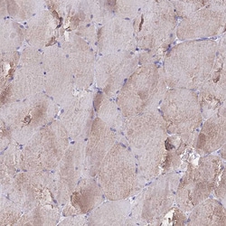Invitrogen TMEM117 Polyclonal Antibody 100 &mu;L | Buy Online | Invitrogen&trade; | Fisher Scientific