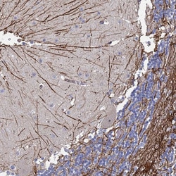 Invitrogen SYT13 Polyclonal Antibody 100 &mu;L; Unconjugated:Antibodies,