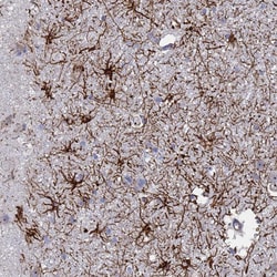 Invitrogen SYT13 Polyclonal Antibody 100 &mu;L; Unconjugated:Antibodies,