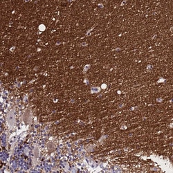 Invitrogen SV2B Polyclonal Antibody 100 &mu;L; Unconjugated:Antibodies,
