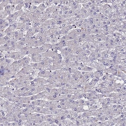 Invitrogen SV2B Polyclonal Antibody 100 &mu;L; Unconjugated:Antibodies,