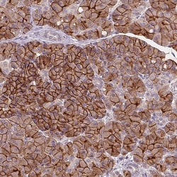 Invitrogen Aquaporin 8 Polyclonal Antibody 100 &mu;L; Unconjugated:Antibodies,