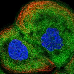 Invitrogen ALDH1A3 Polyclonal Antibody 100 &mu;L; Unconjugated:Antibodies,
