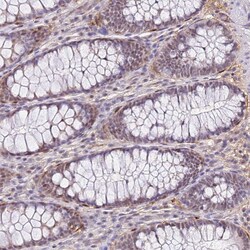 Invitrogen ALDH1A3 Polyclonal Antibody 100 &mu;L; Unconjugated:Antibodies,