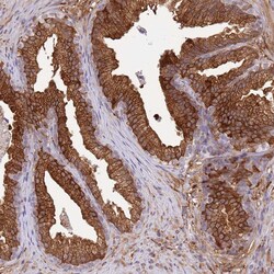 Invitrogen ALDH1A3 Polyclonal Antibody 100 &mu;L; Unconjugated:Antibodies,