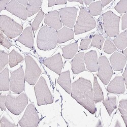 Invitrogen ALDH1A3 Polyclonal Antibody 100 &mu;L; Unconjugated:Antibodies,