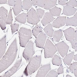 Invitrogen ALDH1A3 Polyclonal Antibody 100 &mu;L; Unconjugated:Antibodies,