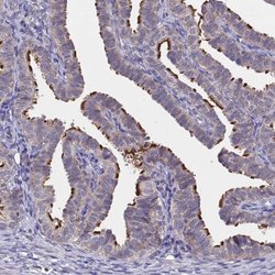 Invitrogen C16orf93 Polyclonal Antibody 100 &mu;L; Unconjugated:Antibodies,