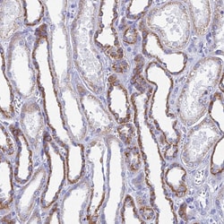 Invitrogen ACSM1 Polyclonal Antibody 100 &mu;L | Buy Online | Invitrogen&trade; | Fisher Scientific