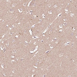 Invitrogen PGRP-L Polyclonal Antibody 100 &mu;L; Unconjugated:Antibodies,