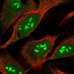 Invitrogen MOB2 Polyclonal Antibody 100 &mu;L; Unconjugated:Antibodies,
