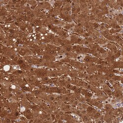 Invitrogen PGM1 Polyclonal Antibody 100 &mu;L; Unconjugated:Antibodies,
